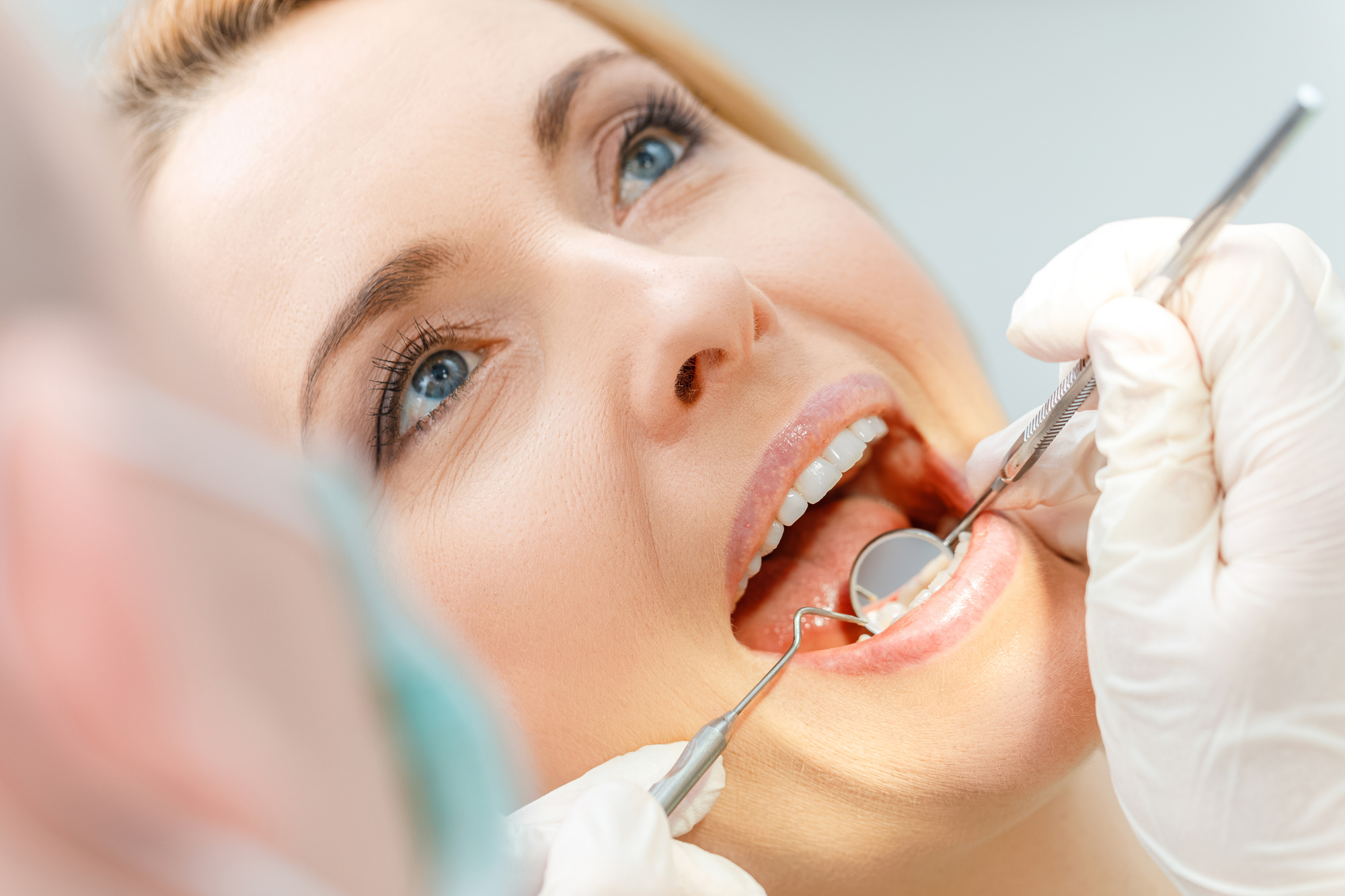 Cosmetic Dentistry Mississauga