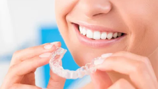 Dental Crowns Mississauga