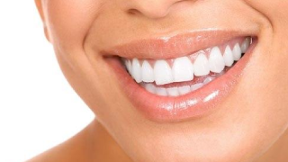 Dental Restoration Mississauga